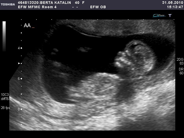 Attached Image: Baby A.jpg